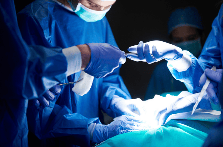 Arthroscopy Surgery