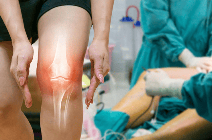 Joint Replacement Surgery